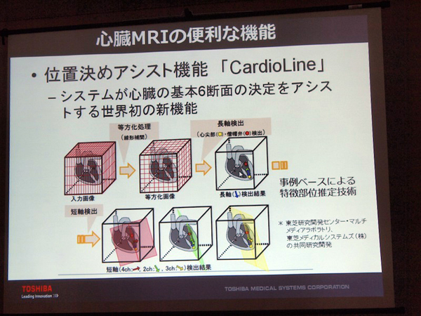 心臓MRIを容易にするCadioLine