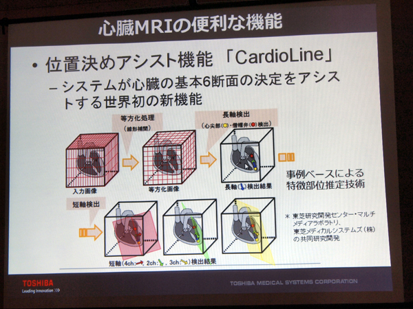 心臓MRI検査を効率化するCardioLine