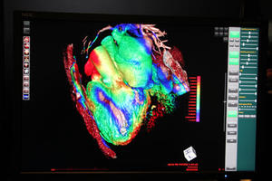 PhyZiodynamicsによる心臓機能解析