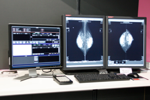マンモグラフィ専用画像診断ワークステーション「mammary」