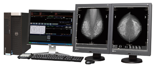 マンモグラフィ専用画像診断ワークステーション「mammary」