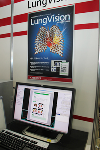 肺気腫計測ソフト「LungVision2」の新機能を紹介