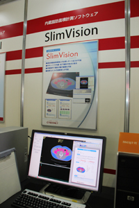 メタボリック検診用ツール内臓脂肪面積計測ソフト「SlimVision5」