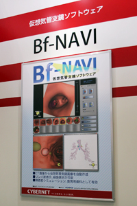 仮想気管支鏡画像を作成し気管支鏡検査をサポートする「Bf-NAVI」