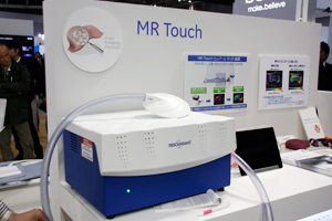 2012年に提供が開始されたMRエラストグラフィ“MR Touch”