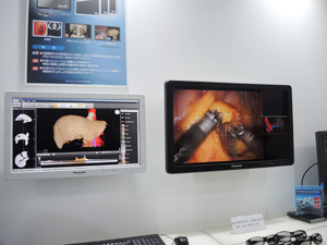 術前シミュレーションや手術画像を表示する2Dモニタ（左）と3Dモニタ