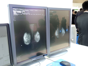 優れた操作性を持つマンモグラフィ専用画像診断ワークステーション「Plissimo MG」