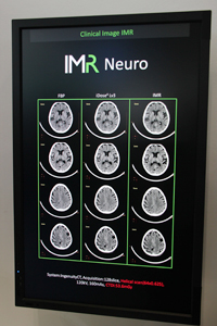 ITEMでは脳神経領域への対応が発表された。