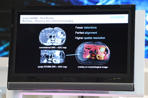 4月に薬事承認された局所選択励起撮像が可能な「syngo ZOOMit」