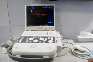 ポータブルタイプの超音波診断装置「ACUSON P300」