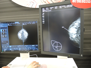 コンソール上でのマーキングが可能となった乳房X線撮影装置「Pe・ru・ru DIGITAL」
