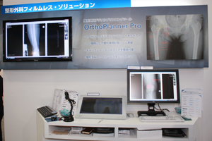 整形外科デジタルプランニングツール「OrthoPlanner Pro」