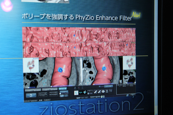 CTCでの読影者の診断を支援する“PhyZio Enhance Filter”