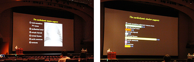 クリッカーを用いて会場の参加者が出題に回答するインタラクティブなやりとりを実施 集計結果がグラフ化されて表示される。