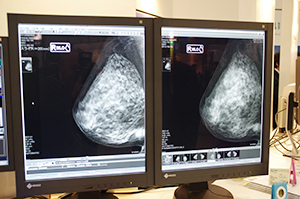 トモシンセシス画像にも対応しているmammary