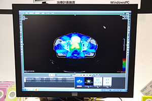 Climb RT ViewerでのCT画像とRTデータの重ね合わせ