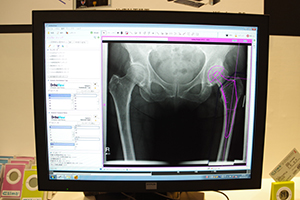 OrthoViewは，ウィザード機能で容易な計測を実現
