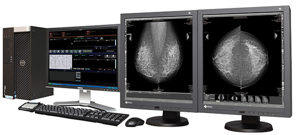 [mammary]マンモグラフィ専用画像診断ワークステーション