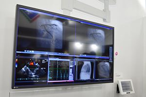 6月発売の58インチ手術室向けモニター「RadiForce LS580W」