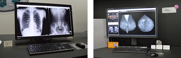 FDA510(k) for Mammographyを取得したマルチモダリティモニターRadiForce RX850