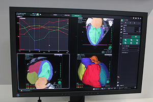 4室の自動認識と解析，計測が可能な心臓4チェンバー解析