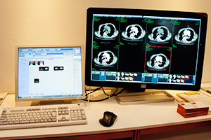 医用画像ソリューション（PACS）「HOPE DrABLE」