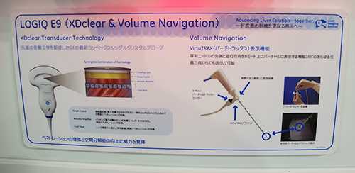Liver Solutionコーナーで紹介されたXDclear TransducerとVolume Navigation（VirtuTRAX）