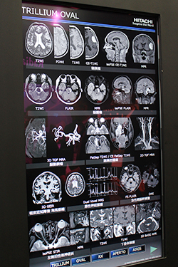 TRILLIUM OVALのさまざまな領域の臨床画像を展示