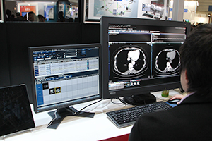 読影支援や配信機能を強化した統合画像ビューワXTREK VIEW