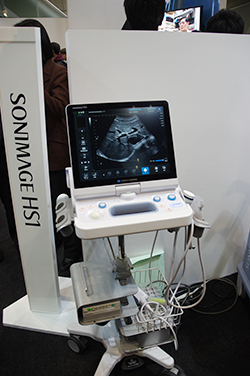 X線装置の画像処理技術を応用し高画質を実現したSONIMAGE HS1