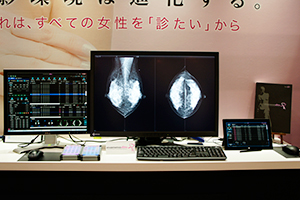 マンモグラフィ画像診断ワークステーション「mammodite」