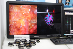 専用の3D眼鏡により立体視できる3Dモニタは手術支援や医学教育に有用