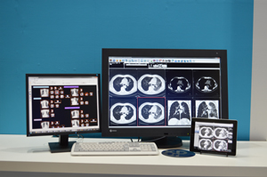 症例ファイル管理システム「EV Palette」