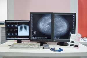 マンモグラフィ専用画像ワークステーション「EV Insite M」