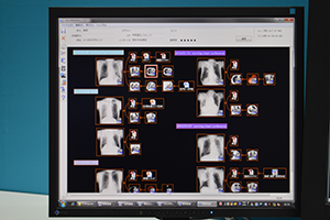 マインドマップにより自由なレイアウトで症例データ整理が可能