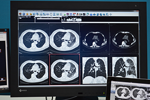 ワンクリックで必要なスライス，コントラストの画像を表示