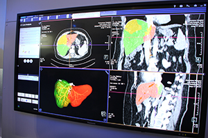 syngo.viaは最新バージョンのVA30を展示。解剖学的な形状の自動認識技術によって処理を行う“ALPHA technology”を採用したアプリケーションを紹介