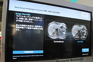 体動に強い撮像法であるFREEZEItを紹介