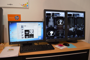 クラウドPACS「NOBORI」