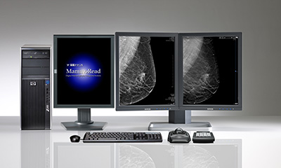 「デジタル・マンモグラフィ画像診断」コーナー