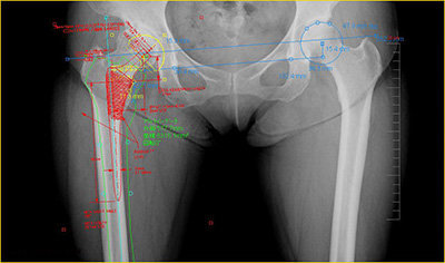 「整形外科フィルムレス・ソリューション」コーナー
