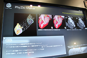 ziostation2で利用可能なPhyZio Maker。PhyZiodynamicsの技術による動態補完，ノイズ除去が可能