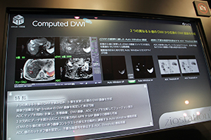 同，Computed DWI。2つの異なるb値の拡散強調画像から画像処理でDWIを作成し，高b値の画像を推定して表示可能