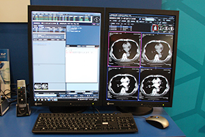 「AmiVoice Ex7 Rad」。新しい保守サービスが今秋を目処に検討されている。