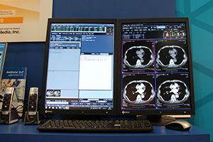 放射線科の読影診断に特化した音声入力辞書を搭載した「AmiVoice Ex7 Rad」