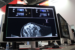 「Coronis Uniti」。1つのモニタに画像を集約できるため，設置スペースも小さくてすむ。