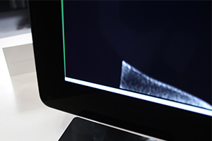「Coronis Uniti」では前面の保護ガラスと液晶面の間に空間がないことで，映りこみの軽減や画像の鮮明化につながっている。