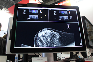 1つのモニタに画像を集約できるため設置スペースも小さくなる「Coronis Uniti」