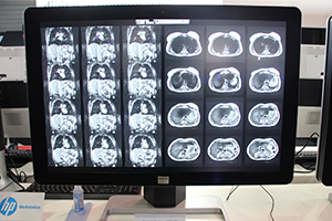 輝度均一化技術“カラーPPU”の搭載で輝度ムラがほとんどない「Coronis Fusion 6MP LED」