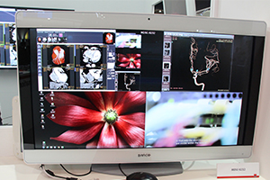 58インチと遜色のない画像を表示できる4K解像度の外科用ディスプレイ「MDSC-8232」